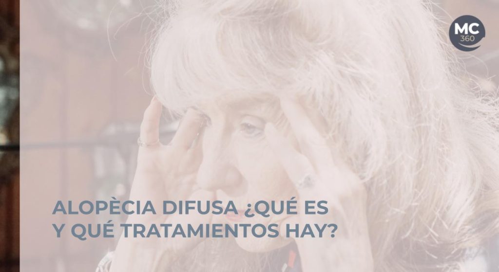 Alopecia difusa mujer